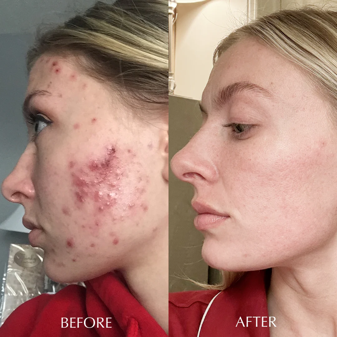 Muse Labs 7% Glycolic Acid Toner | Exfoliating Solution with 5D Hyaluronic Acid & Peptides | Smooth, Bright & Hydrated Skin
