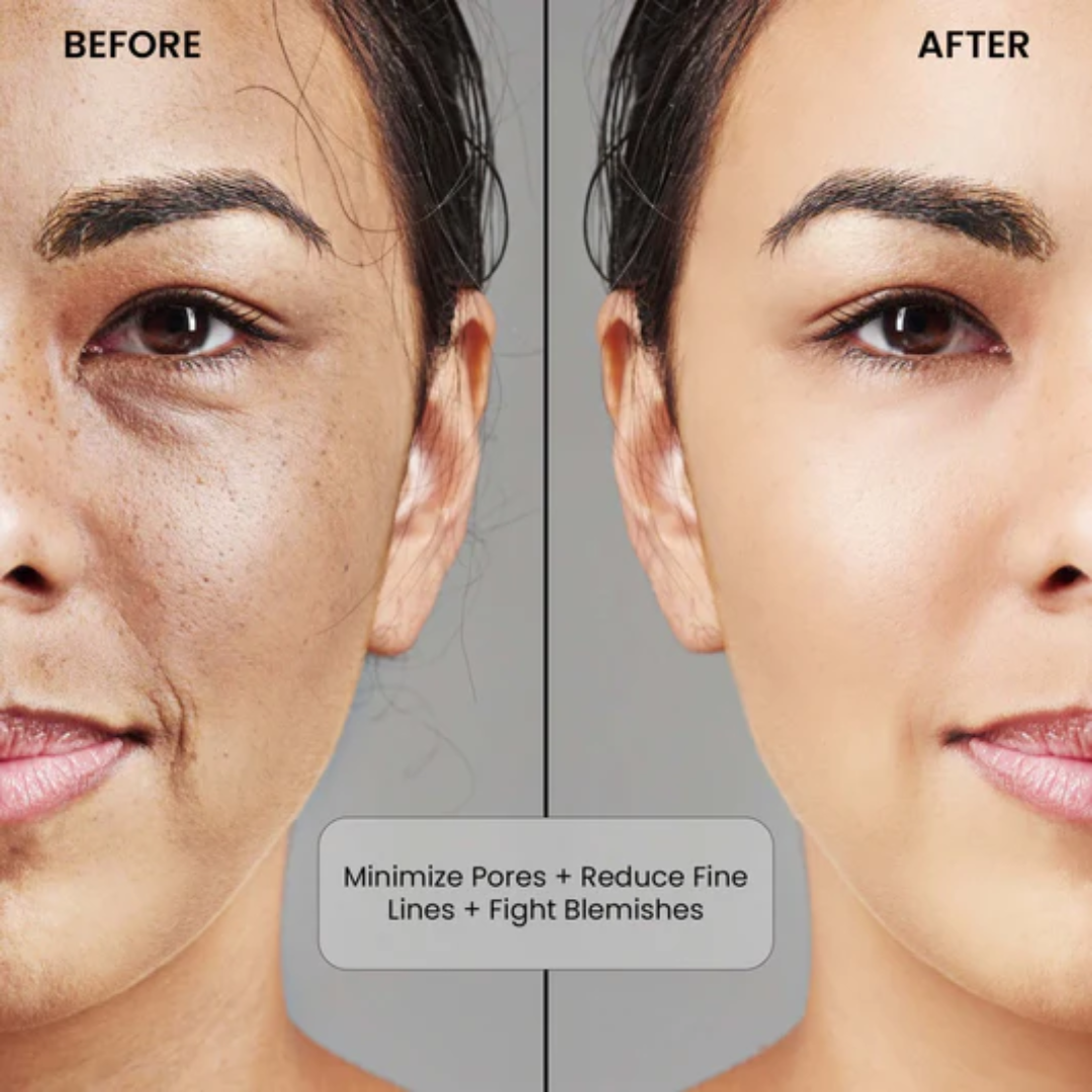 L'Oreal pink Exfoliating Peel | Facial Like Glow in Just 15 minutes | Anti dark spot, Pore minimizing, Brighten Skin tone