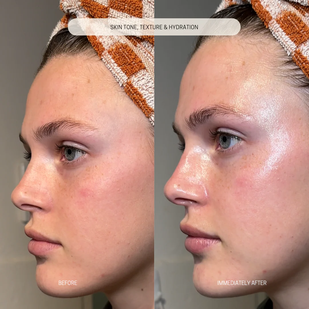 RENEE Immortal Face Cream | All-in-One Moisturizer | Nourishes, Repairs, Renews & Protects | Remove pigmentation, dark spots & brighten skin tone | For All Skin Types