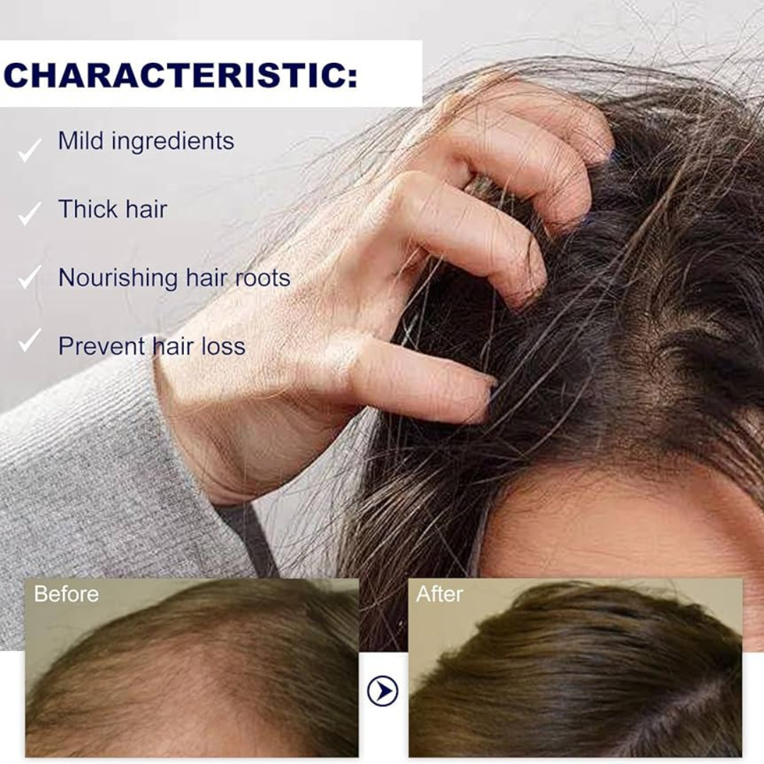 Bare Anatomy Advanced Hair Growth Roll-On Serum | 3% Redensyl + 4% Anagain + 2% Baicapil + 5% Rosemary | Direct Scalp Application for Thicker, Stronger Hair