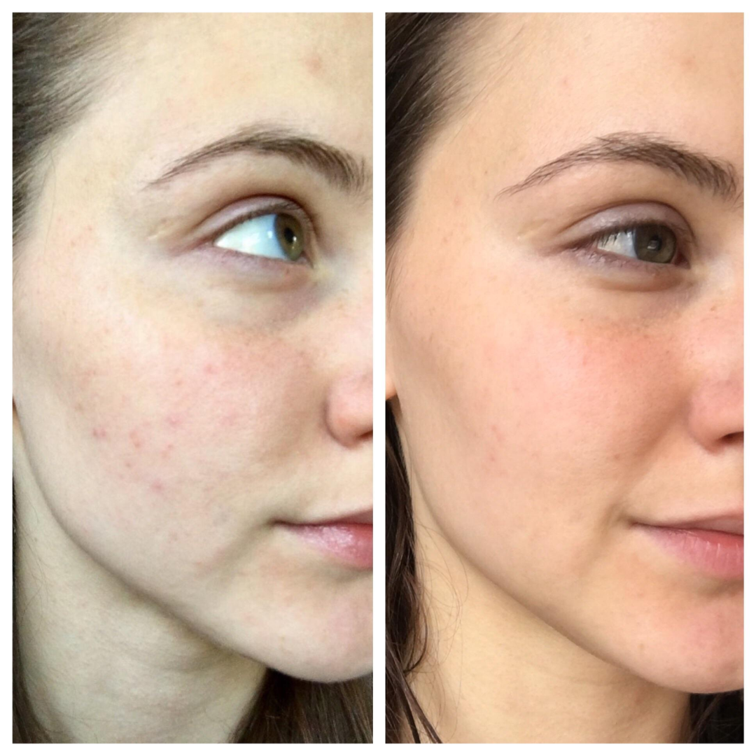 Muse Labs 7% Glycolic Acid Toner | Exfoliating Solution with 5D Hyaluronic Acid & Peptides | Smooth, Bright & Hydrated Skin