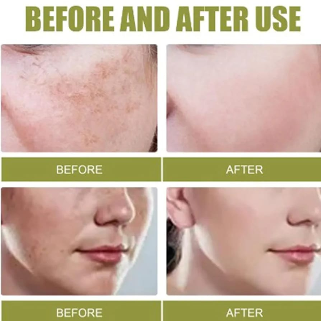 RENEE Immortal Face Cream | All-in-One Moisturizer | Nourishes, Repairs, Renews & Protects | Remove pigmentation, dark spots & brighten skin tone | For All Skin Types