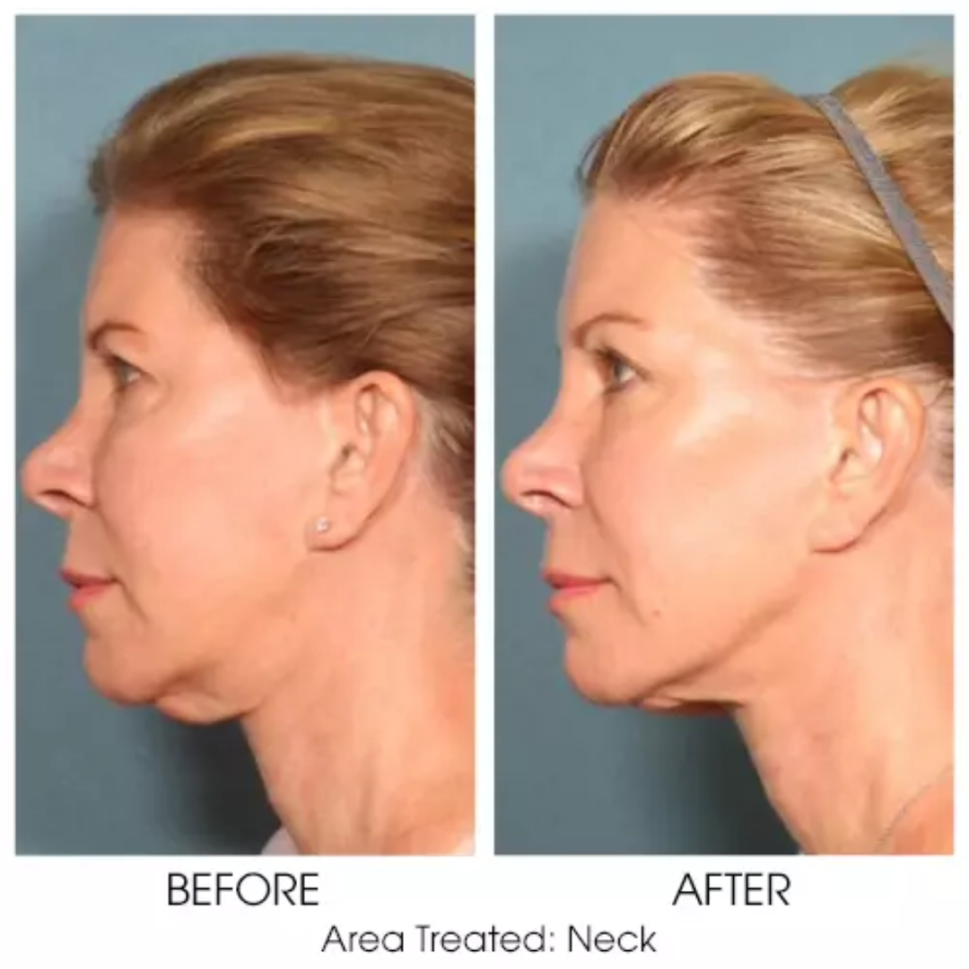 Magec Collagen Fullerene Neck Cream | Tightening & Anti-Wrinkle Formula with Collagen, Fullerene & Niacinamide | Reduces Neck Lines, Firms & Hydrates