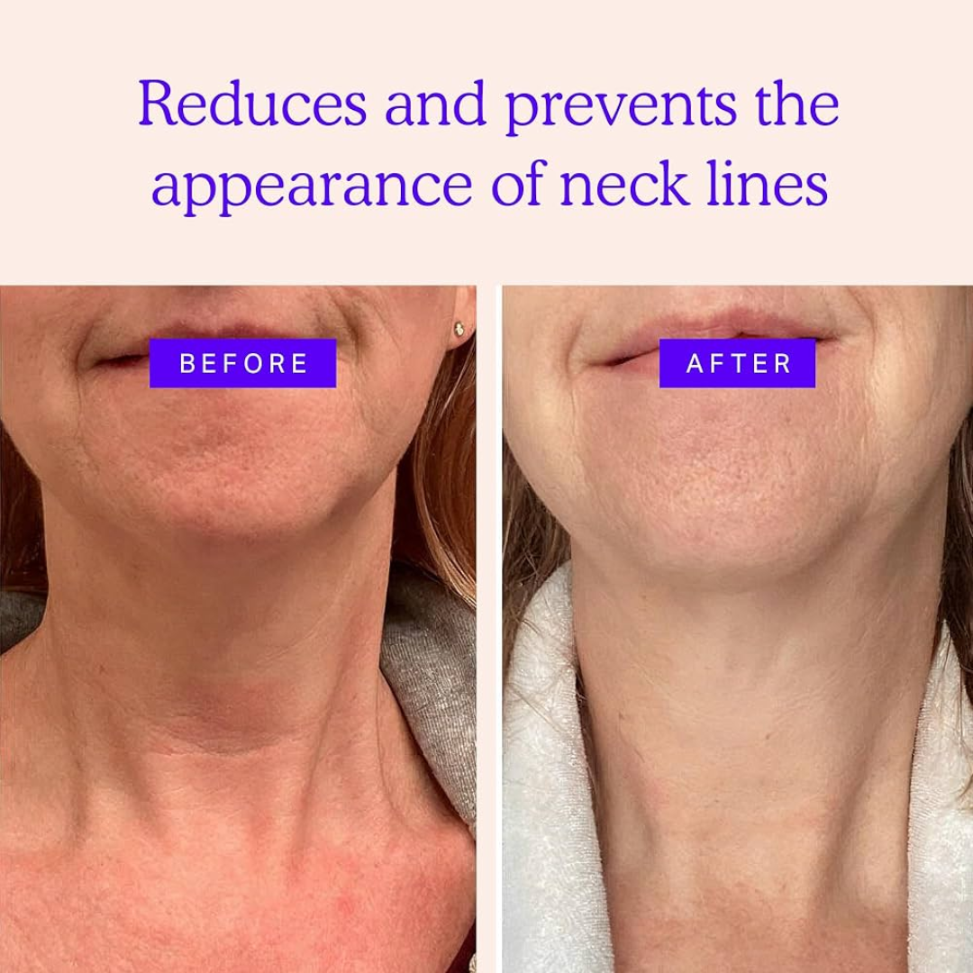 Magec Collagen Fullerene Neck Cream | Tightening & Anti-Wrinkle Formula with Collagen, Fullerene & Niacinamide | Reduces Neck Lines, Firms & Hydrates