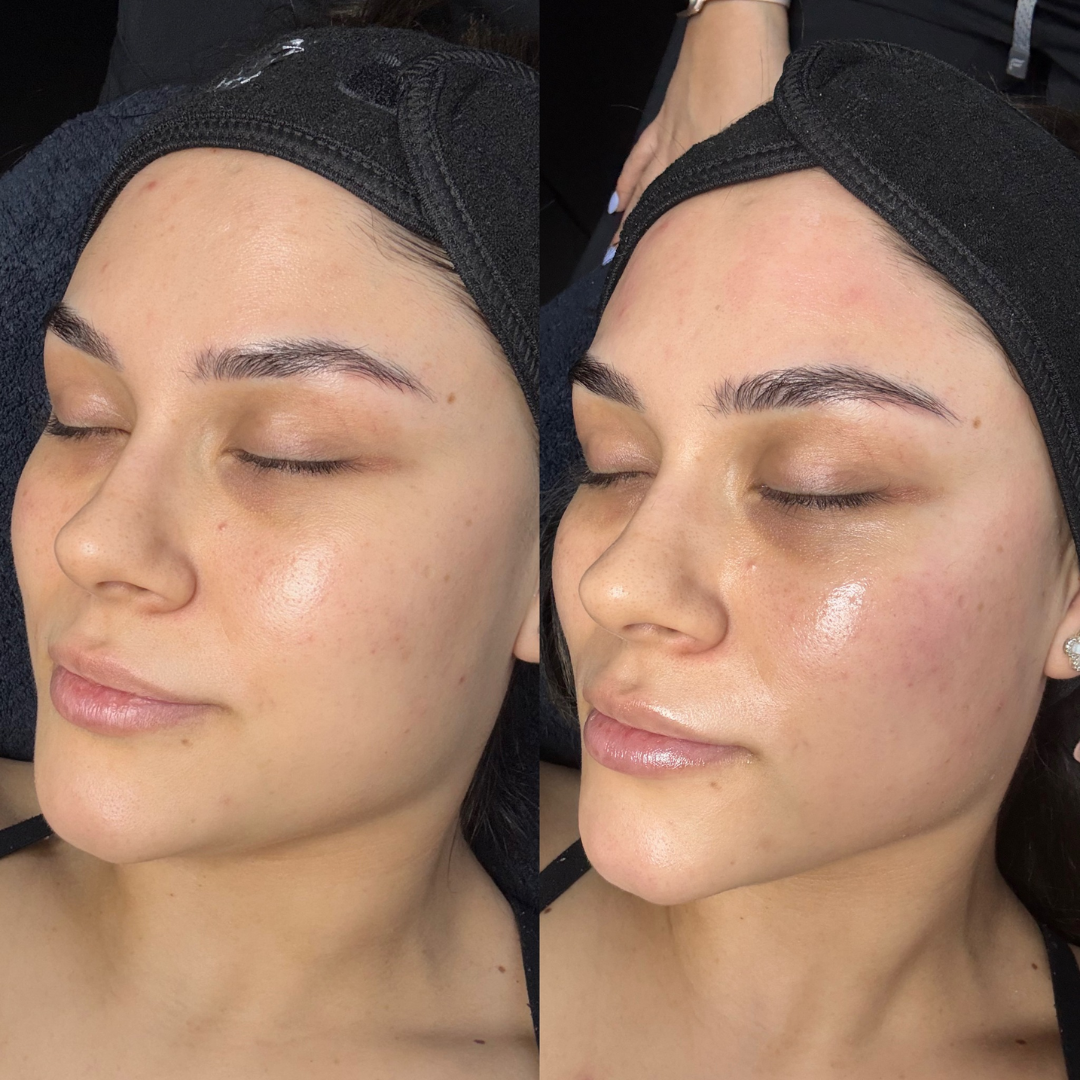 L'Oreal pink Exfoliating Peel | Facial Like Glow in Just 15 minutes | Anti dark spot, Pore minimizing, Brighten Skin tone