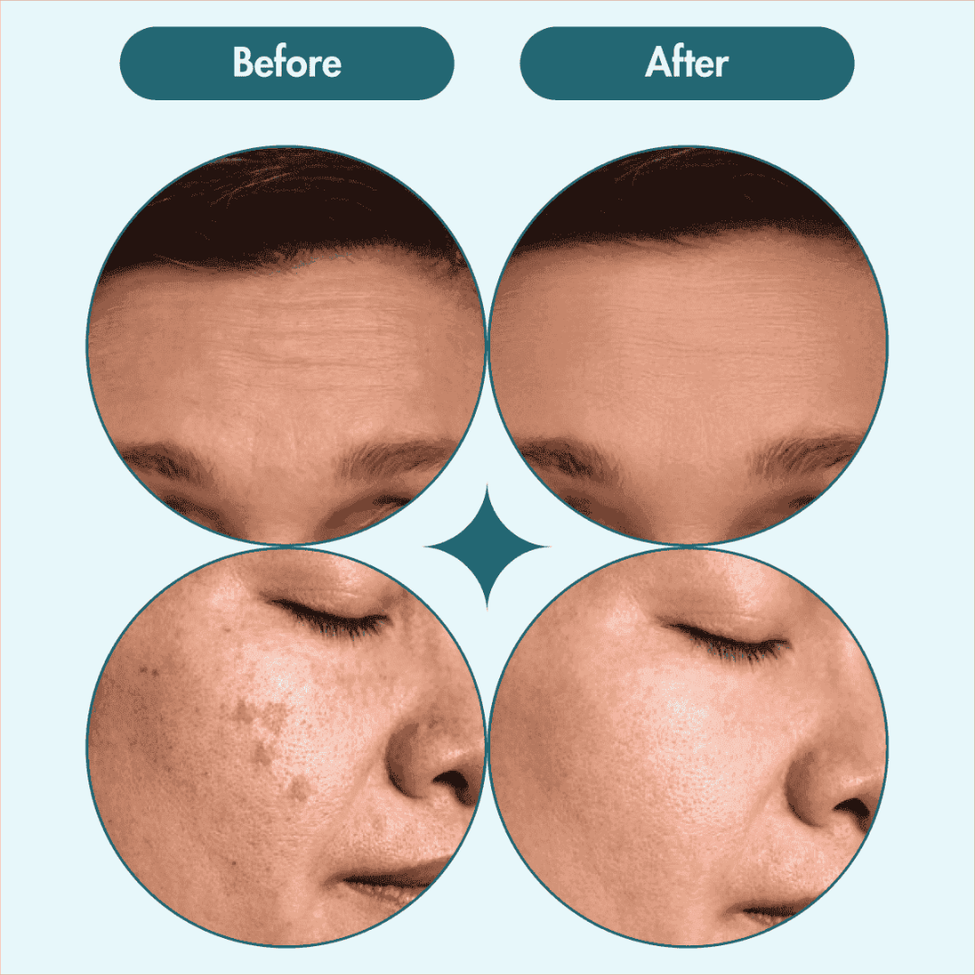 L'Oreal pink Exfoliating Peel | Facial Like Glow in Just 15 minutes | Anti dark spot, Pore minimizing, Brighten Skin tone