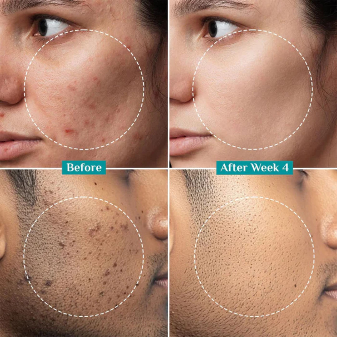 RENEE Immortal Face Cream | All-in-One Moisturizer | Nourishes, Repairs, Renews & Protects | Remove pigmentation, dark spots & brighten skin tone | For All Skin Types