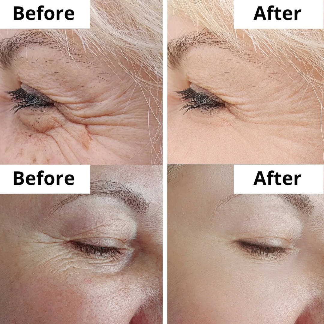 Numbuzin Anti-Wrinkle & Skin Tightening Essence | 50 Peptides Formula For Collagen Boost | Firm, Lifts, Remove Wrinkles & Fine Lines