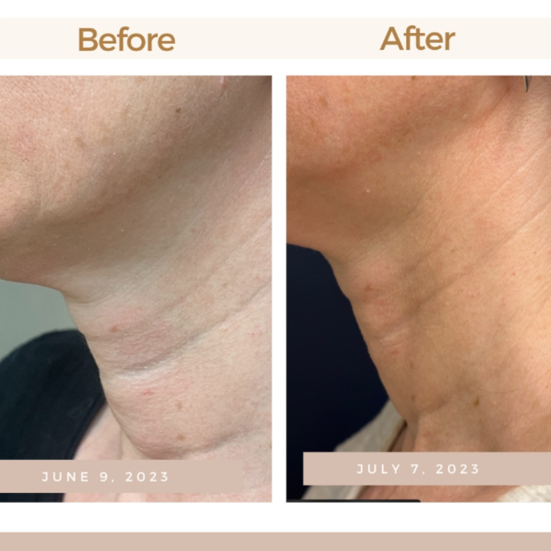 Magec Collagen Fullerene Neck Cream | Tightening & Anti-Wrinkle Formula with Collagen, Fullerene & Niacinamide | Reduces Neck Lines, Firms & Hydrates