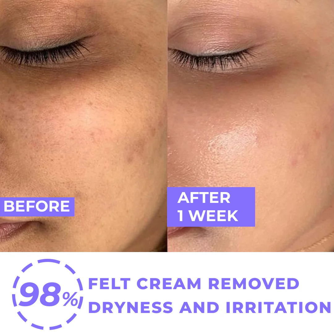 FOREVER52 Hydra Creme Moisturizer & Makeup Base | Intense Hydration, Strengthens Skin Barrier, Evens Skin Tone – Fights Dryness & Pigmentation