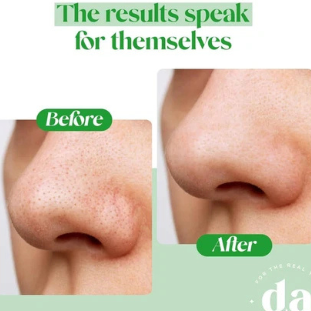 L'Oreal pink Exfoliating Peel | Facial Like Glow in Just 15 minutes | Anti dark spot, Pore minimizing, Brighten Skin tone