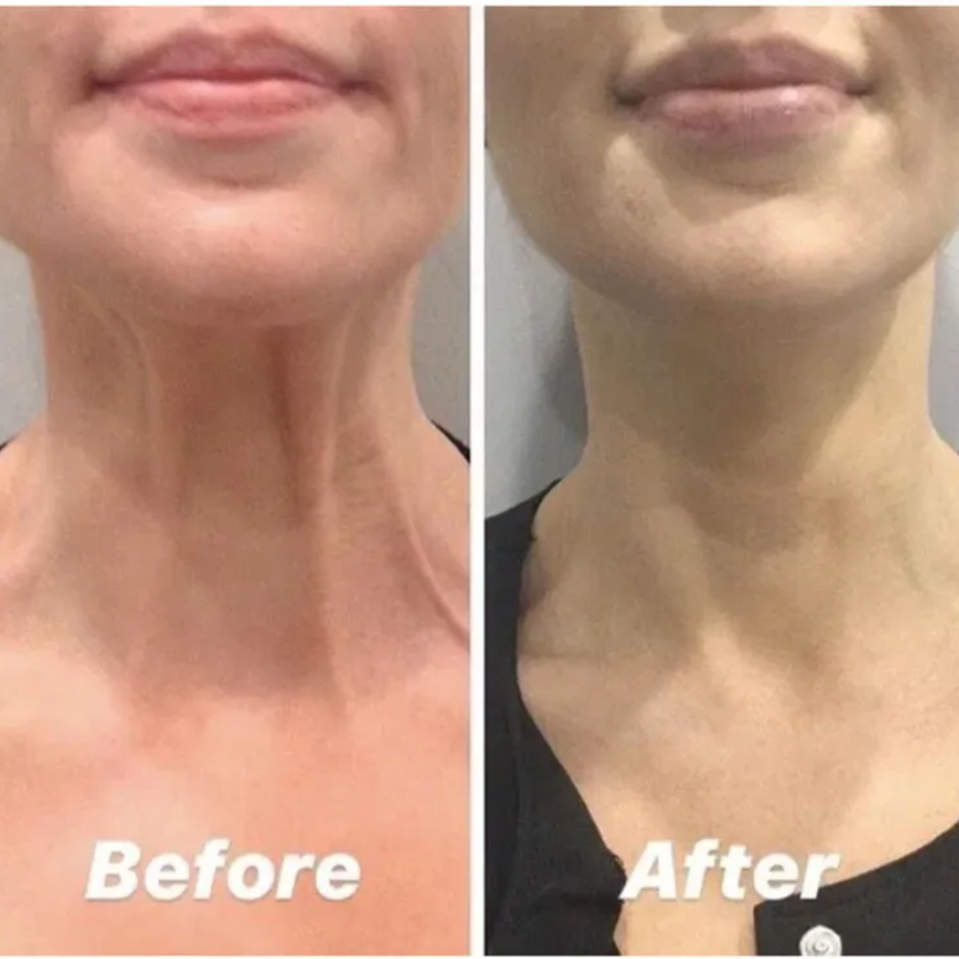 Magec Collagen Fullerene Neck Cream | Tightening & Anti-Wrinkle Formula with Collagen, Fullerene & Niacinamide | Reduces Neck Lines, Firms & Hydrates