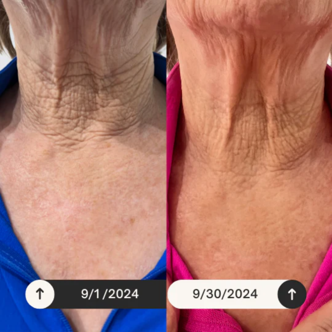 Instant Firm® Skin Tightener | Instantly Tightens, Firms & Smooths Puffiness, Fine Lines, Deep Wrinkles & Crow's Feet – Easy-Wear Formula with Peptides