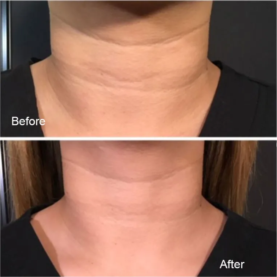 Magec Collagen Fullerene Neck Cream | Tightening & Anti-Wrinkle Formula with Collagen, Fullerene & Niacinamide | Reduces Neck Lines, Firms & Hydrates