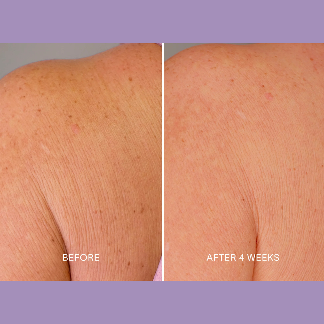 Magec Collagen Fullerene Neck Cream | Tightening & Anti-Wrinkle Formula with Collagen, Fullerene & Niacinamide | Reduces Neck Lines, Firms & Hydrates