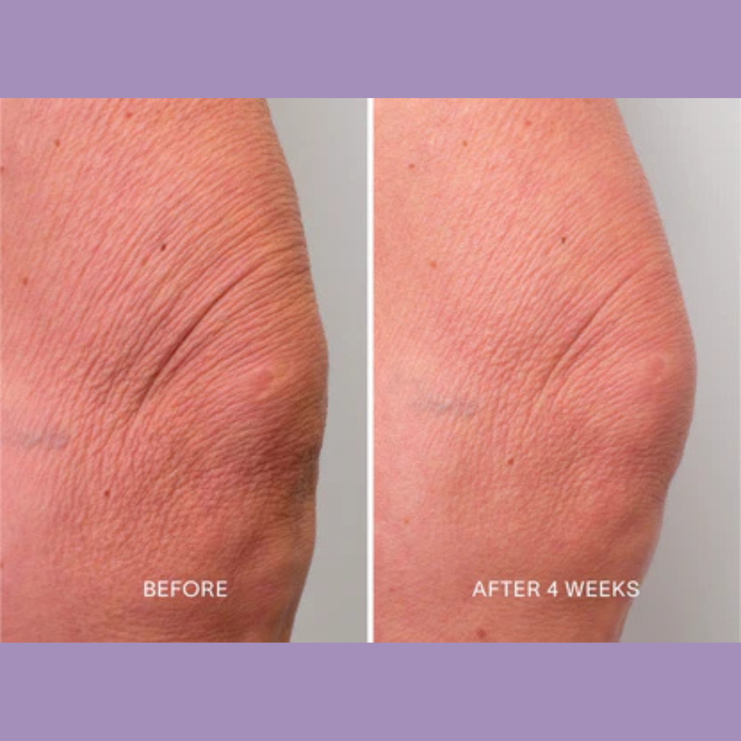 Magec Collagen Fullerene Neck Cream | Tightening & Anti-Wrinkle Formula with Collagen, Fullerene & Niacinamide | Reduces Neck Lines, Firms & Hydrates