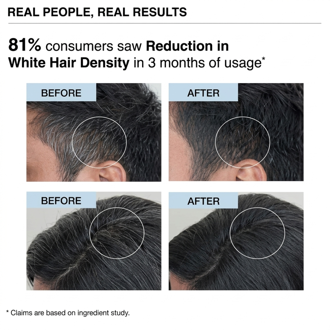 Proskire Grey Hair Solution Serum – Reduces Grey Hair, Nourishes Roots, Revives Natural Color – Targets Premature Greying & White Hair Strands – With Biotin, Rosemary, Ginger & Black Seed Oil – For All Hair Types – 30ml