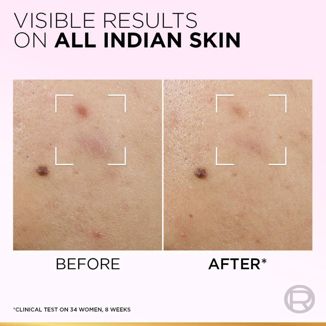 L'Oreal pink Exfoliating Peel | Facial Like Glow in Just 15 minutes | Anti dark spot, Pore minimizing, Brighten Skin tone