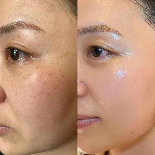 Arencia Vitamin C Booster Shot – 5-in-1 Skin Transformation – Fades Dark Spots, Boosts Radiance, Deep Hydration – For All Skin Types