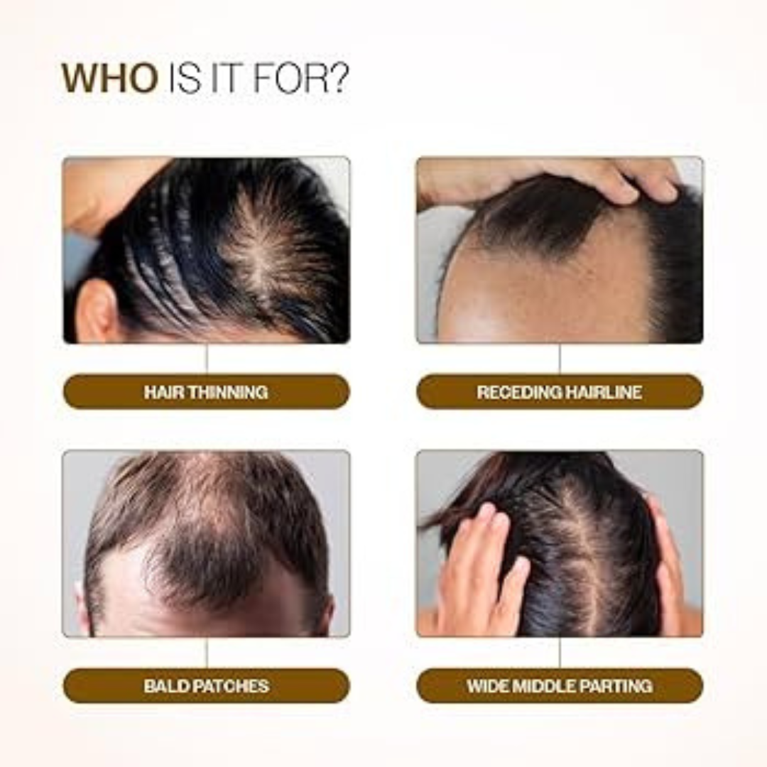 Bare Anatomy Advanced Hair Growth Roll-On Serum | 3% Redensyl + 4% Anagain + 2% Baicapil + 5% Rosemary | Direct Scalp Application for Thicker, Stronger Hair