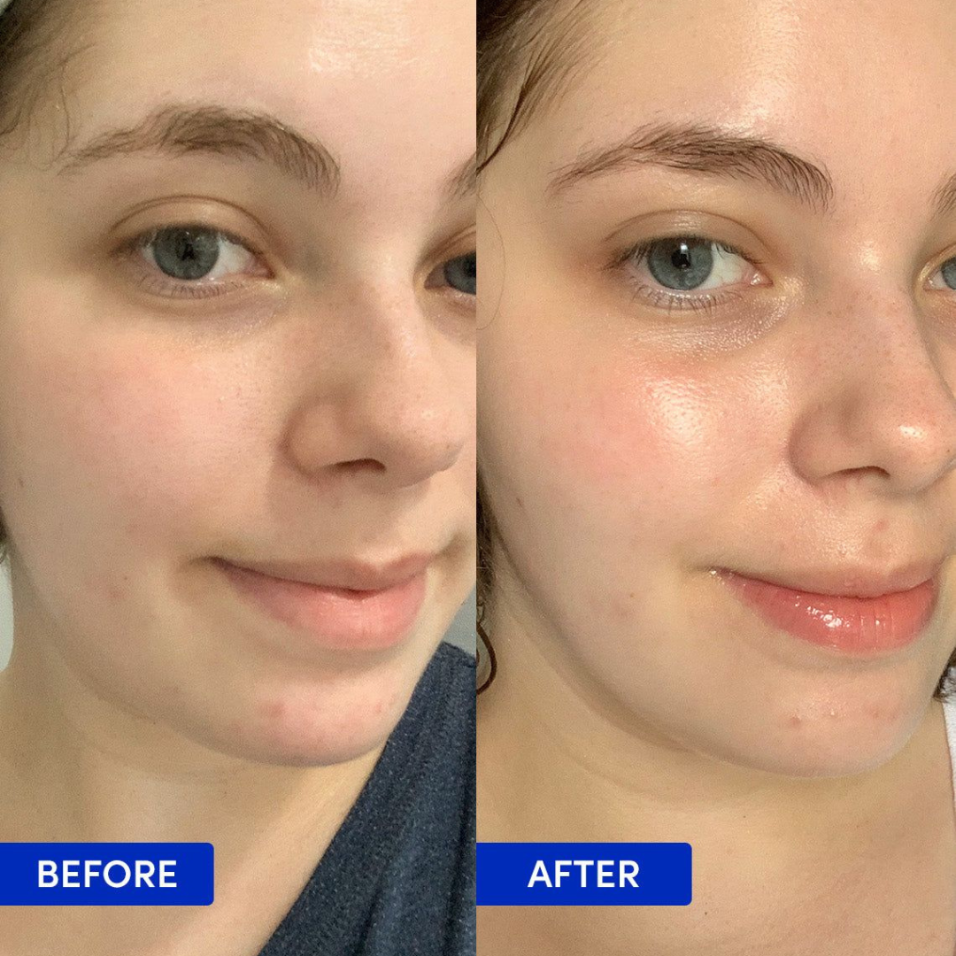 NIVEA Luminous630 Skin Glow Instant Glow Serum – Reduces Dark Spots, Evens Skin Tone, Boosts Radiance – Instant Glow in 1 Use – Lightweight, Fast-Absorbing