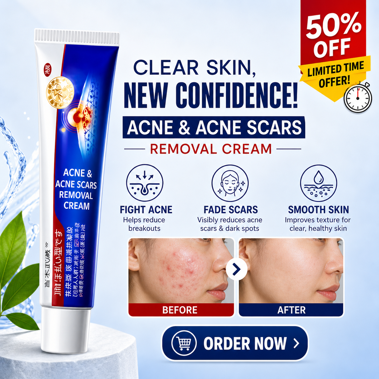 Acne & Acne Scars Removal Cream – Fights Acne, Fades Scars, Smooths Skin – With Salicylic Acid, Niacinamide & Tea Tree Oil – For All Skin Types