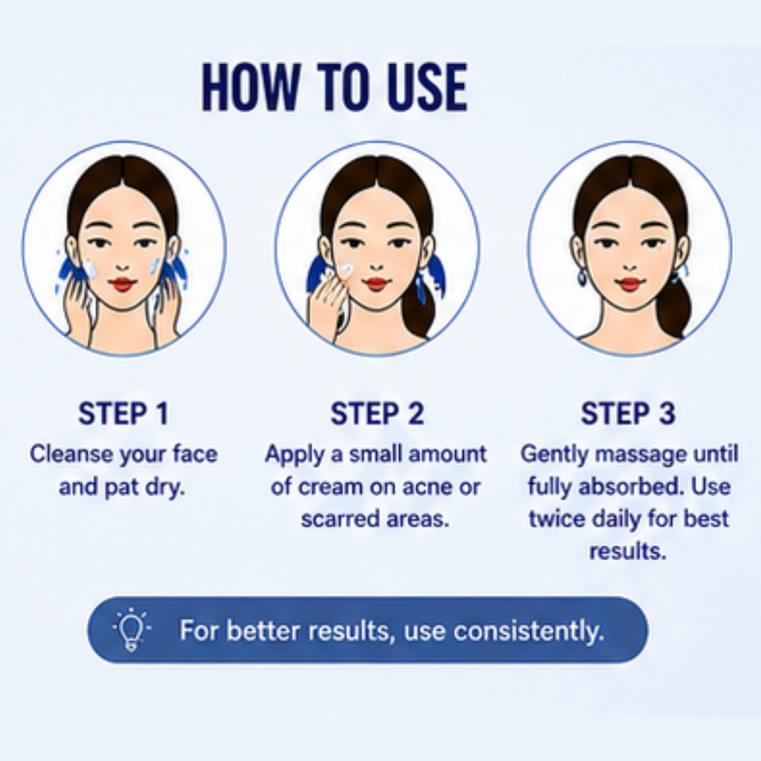 Acne & Acne Scars Removal Cream – Fights Acne, Fades Scars, Smooths Skin – With Salicylic Acid, Niacinamide & Tea Tree Oil – For All Skin Types