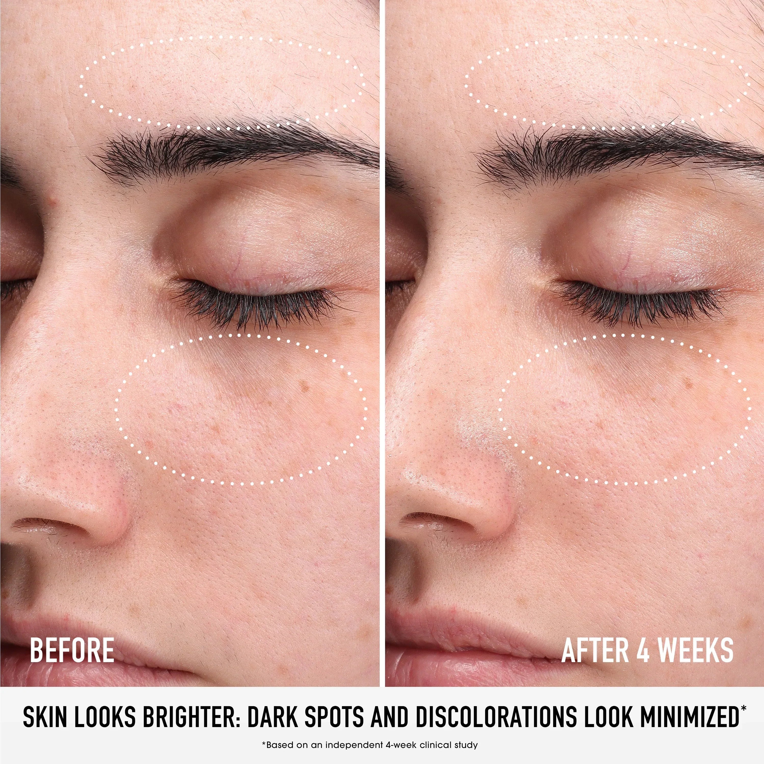 The Muse Labs C-Bright Serum | Brighter, Smoother & Even-Toned Skin in Just 3 Days