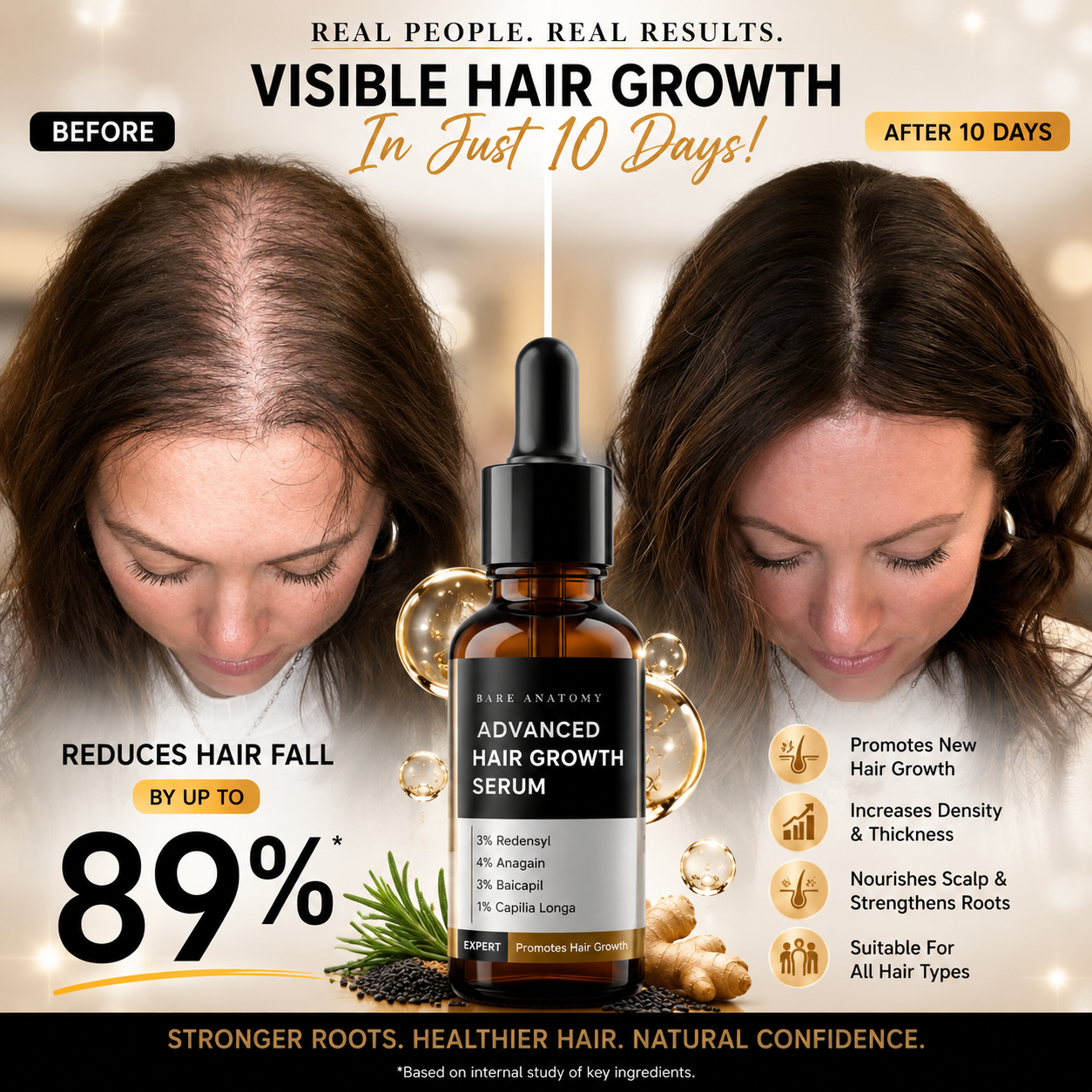 BARE ANATOMY Advanced Hair Growth Serum – Visible Results in 10 Days – Reduces Hair Fall by 89% – Promotes New Growth, Increases Density