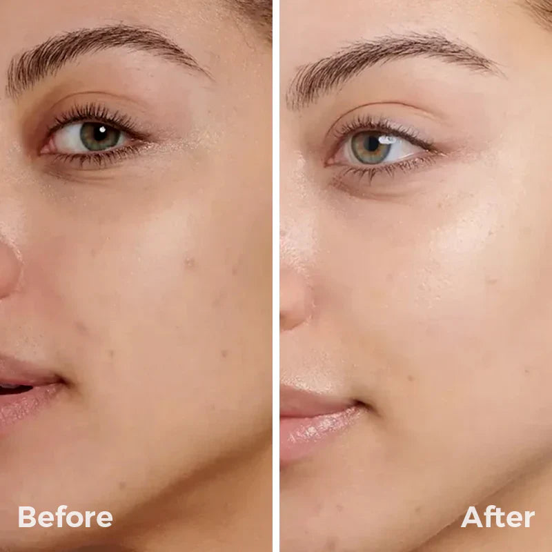 The Muse Labs C-Bright Serum | Brighter, Smoother & Even-Toned Skin in Just 3 Days