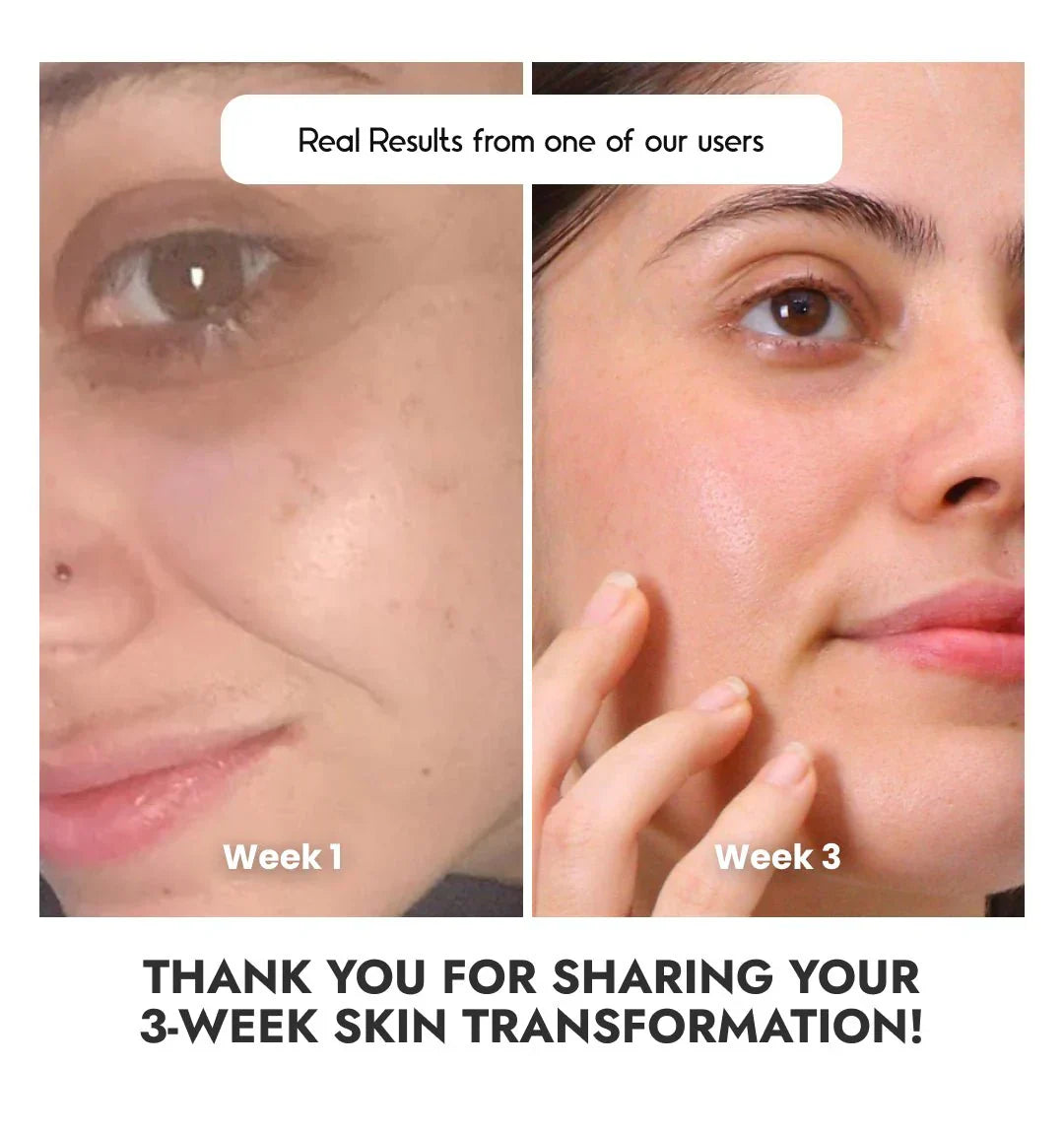 The Muse Labs C-Bright Serum | Brighter, Smoother & Even-Toned Skin in Just 3 Days